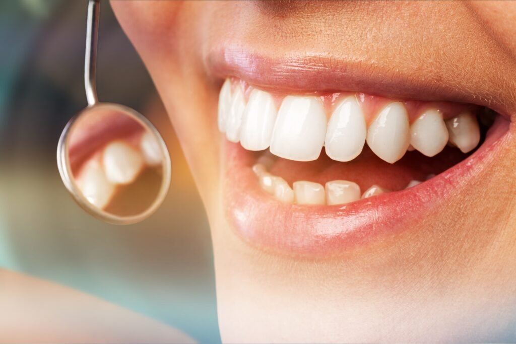 Close-up of a healthy smile – dental bridge treatment in Zira